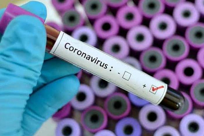 Se reducen los contagios diarios por coronavirus en Colombia: total llega a 422.519